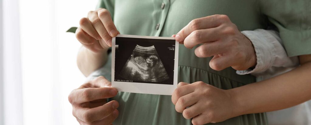 Protocollo di Comunicazione nella Morte Intrauterina